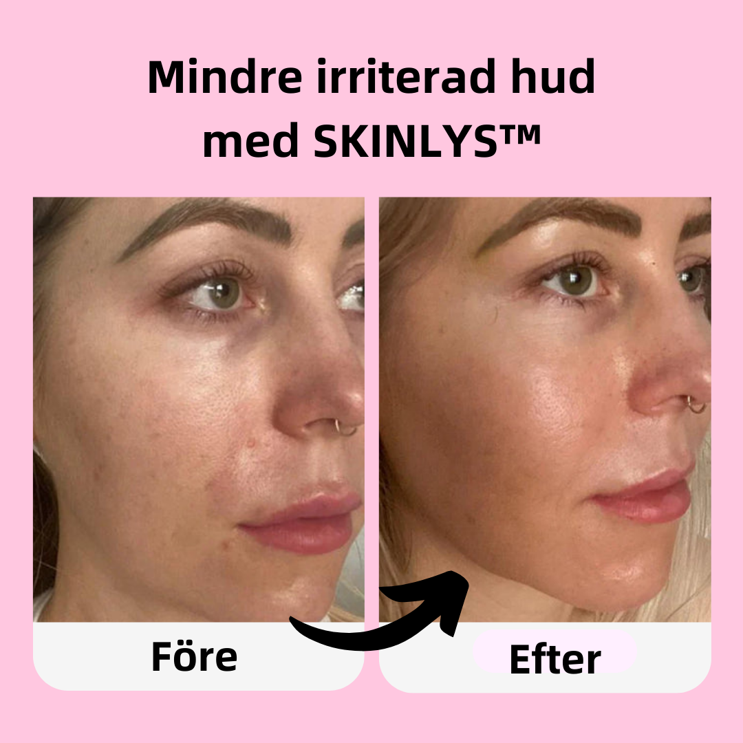 SKINLYS™ - För ett vackert ansikte